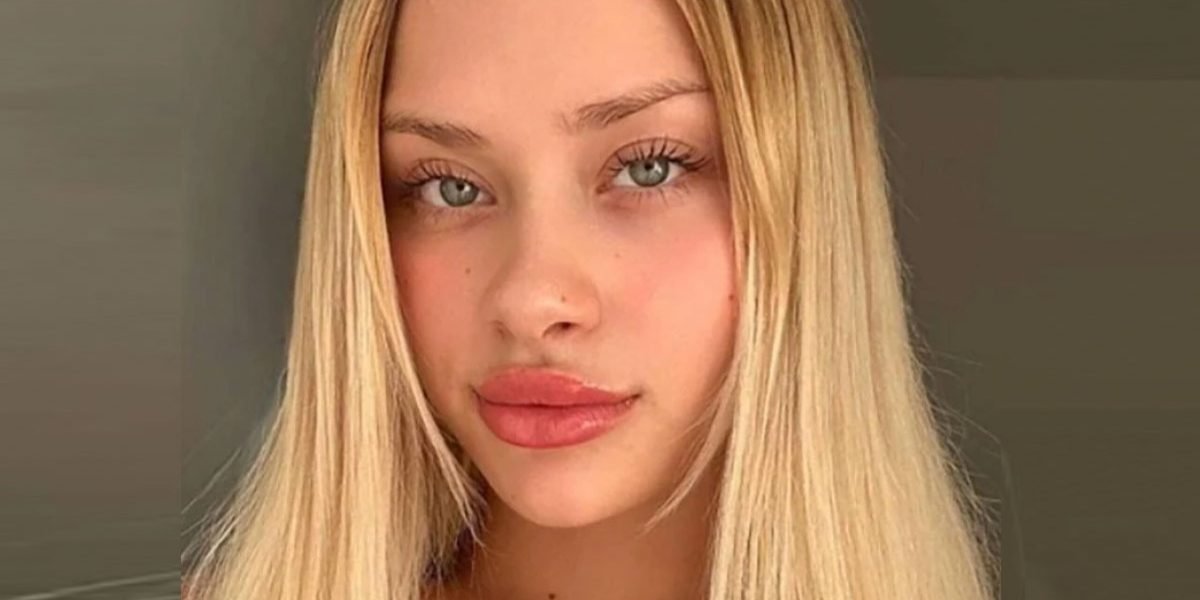 Tras 10 días hallan a modelo desaparecida con los brazos y piernas rotas